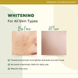Greenika Ultimate Whitening 10X Bleaching Coco-Black Soap