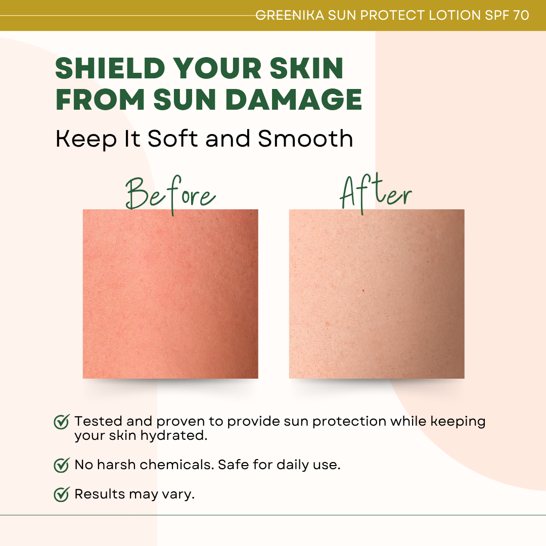 Greenika Sun Protect Sun Block Lotion SPF70 Broad Spectrum