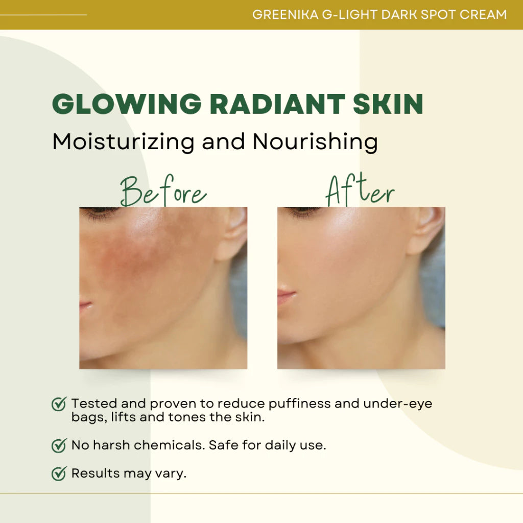 Greenika Dark Spot Remover Cream