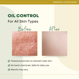 Greenika Organic Lemon Peel Natural Oil Control Anti Acne Soap