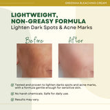 Greenika Face Bleaching Cream