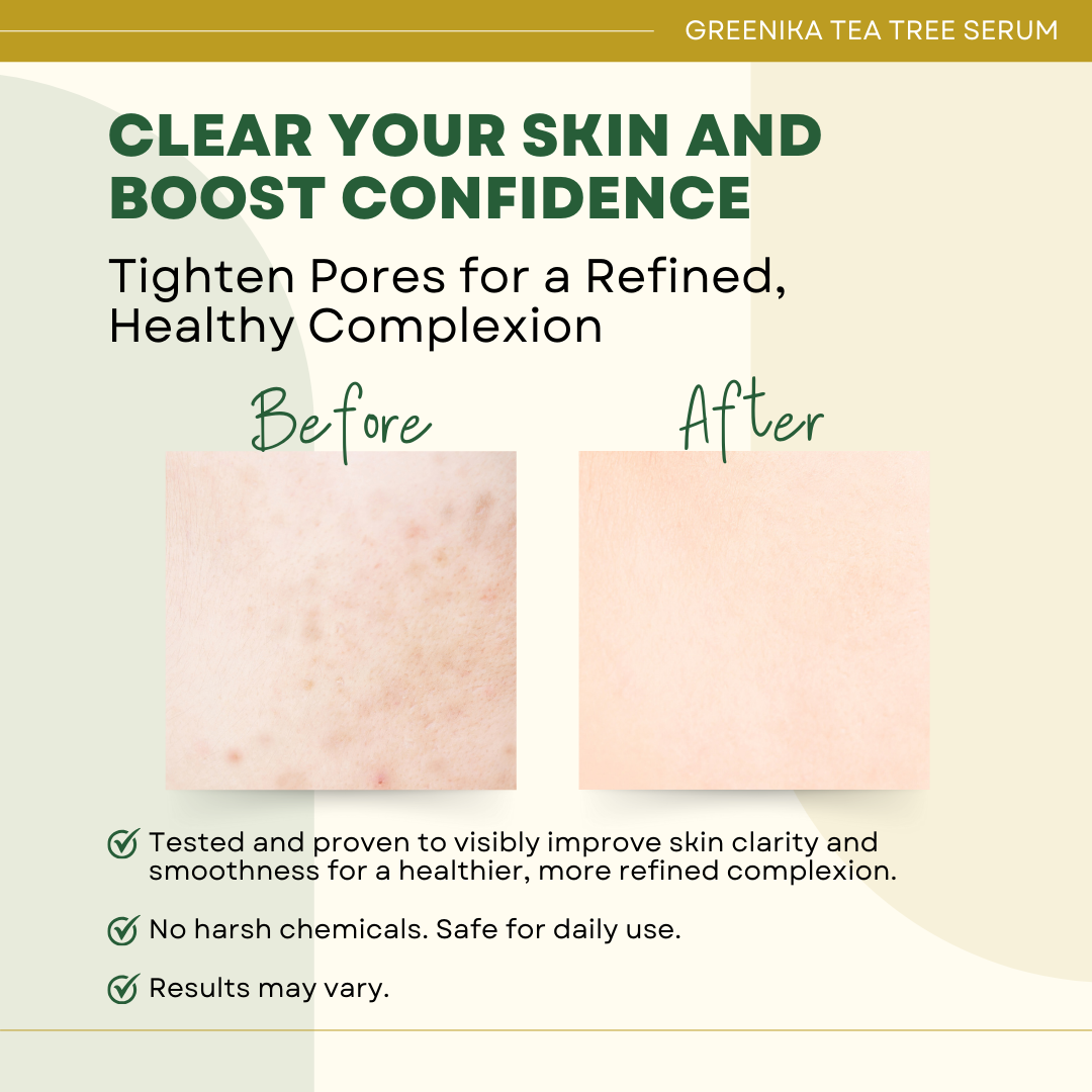 Greenika Tea Tree Serum
