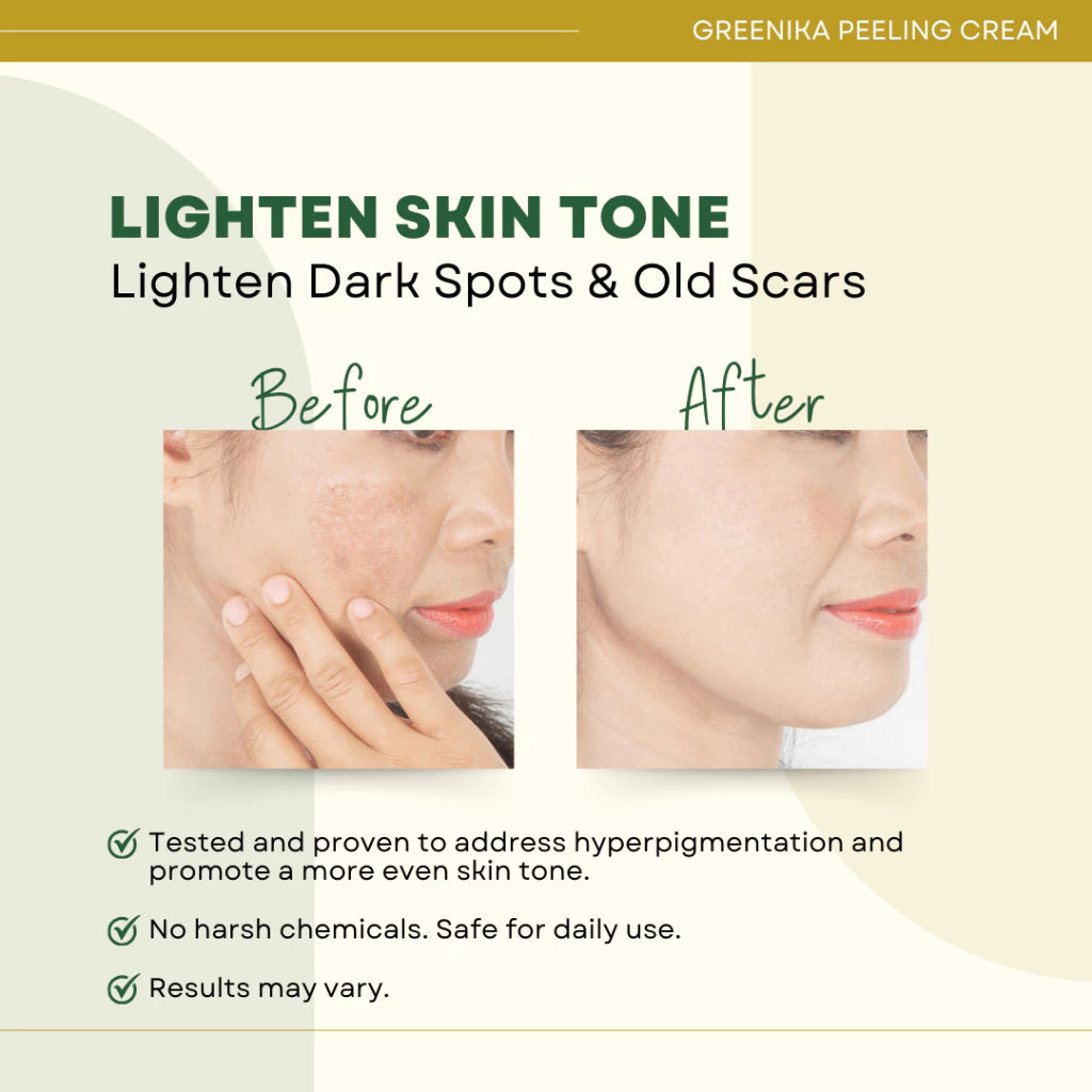 Greenika Peeling Cream