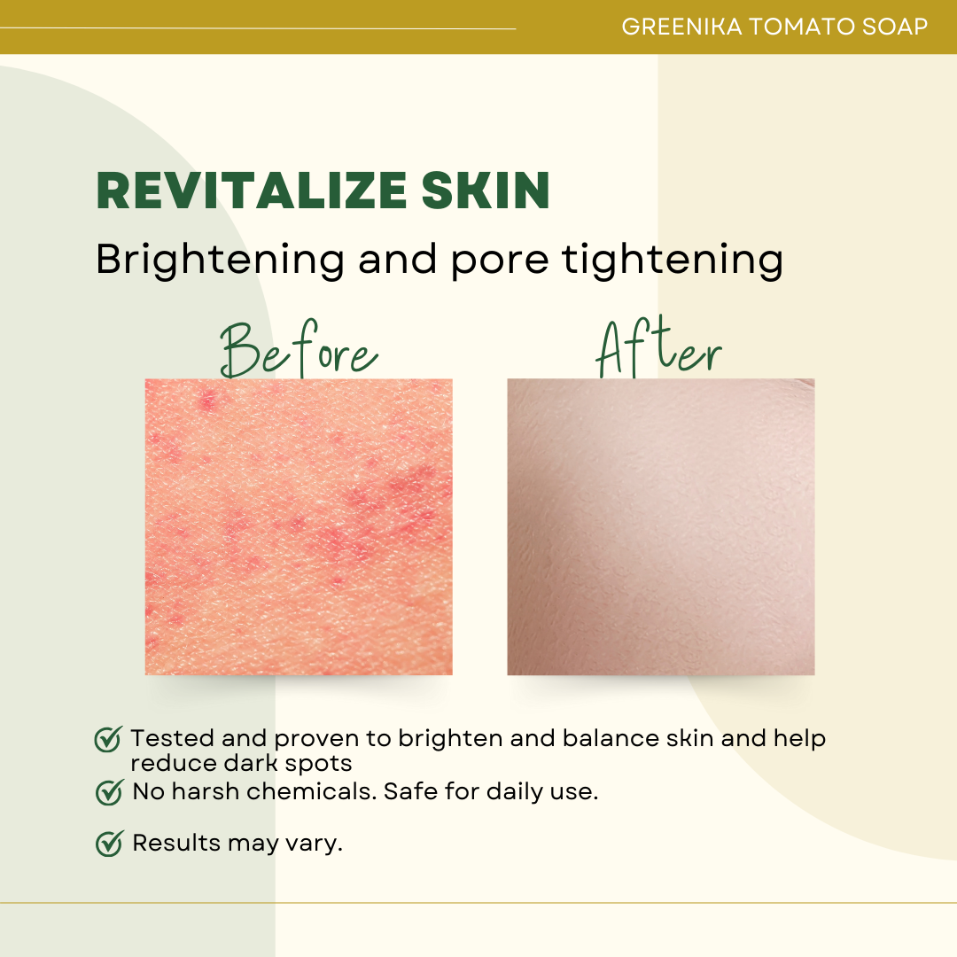Greenika Premium Organic Tomato Natural Whitening Anti Wrinkle Soap