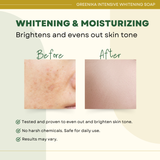 Greenika Organic Intensive Whitening Soap