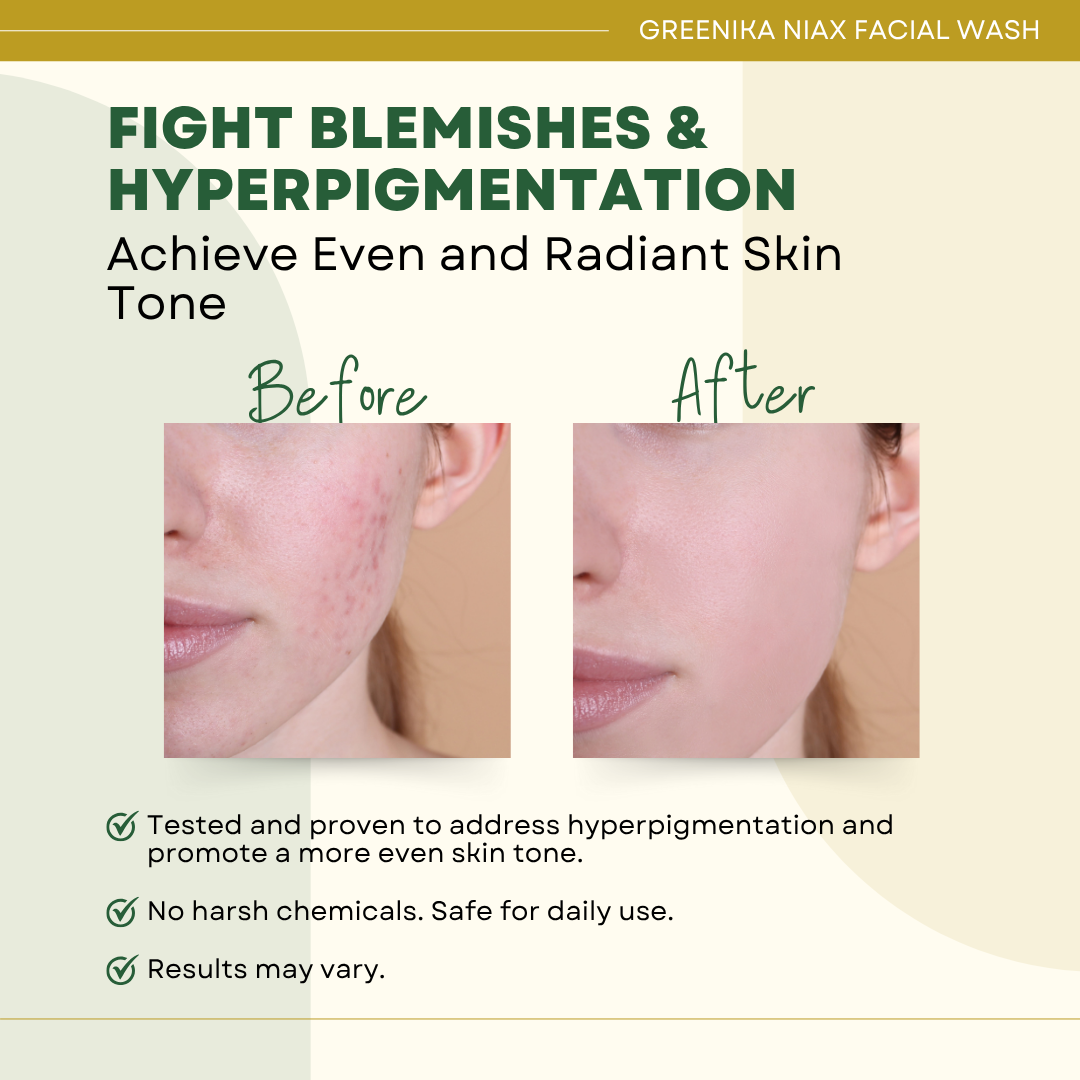 Greenika NiaX Facial Wash Deep & Gentle Cleanser