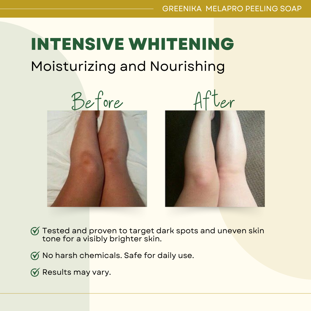 Greenika Melasma Peeling Soap