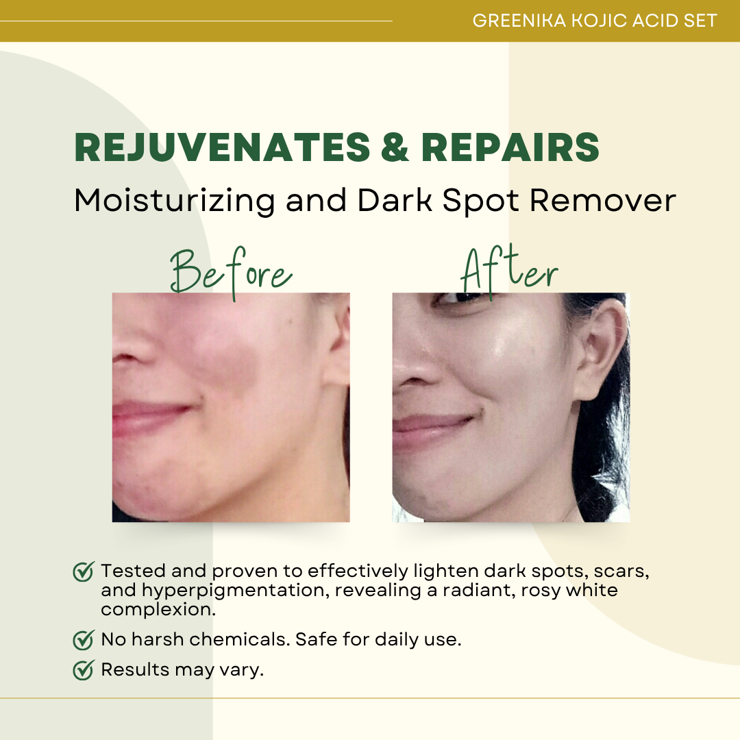 Greenika Kojic Acid Set