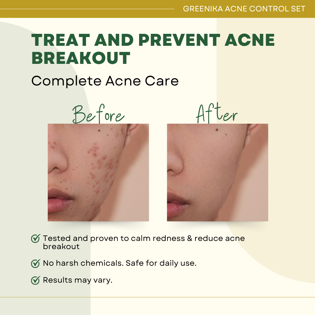 Greenika Acne Control Set