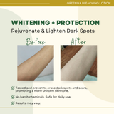 Greenika SPF15 Bleaching Lotion