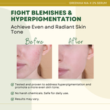 Greenika Extra Strength AHA Whitening Serum with 2% Niacinamide