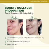 Greenika Snail Relief Gel with Soothing Aloe Vera Gel Extract