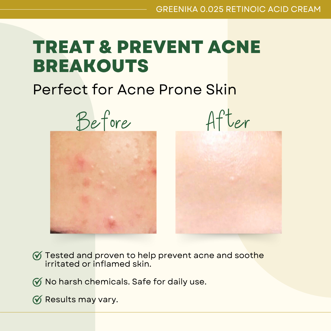 Greenika Retinoic Acid Cream