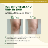 Greenika Knee and Elbow Whitening Cream