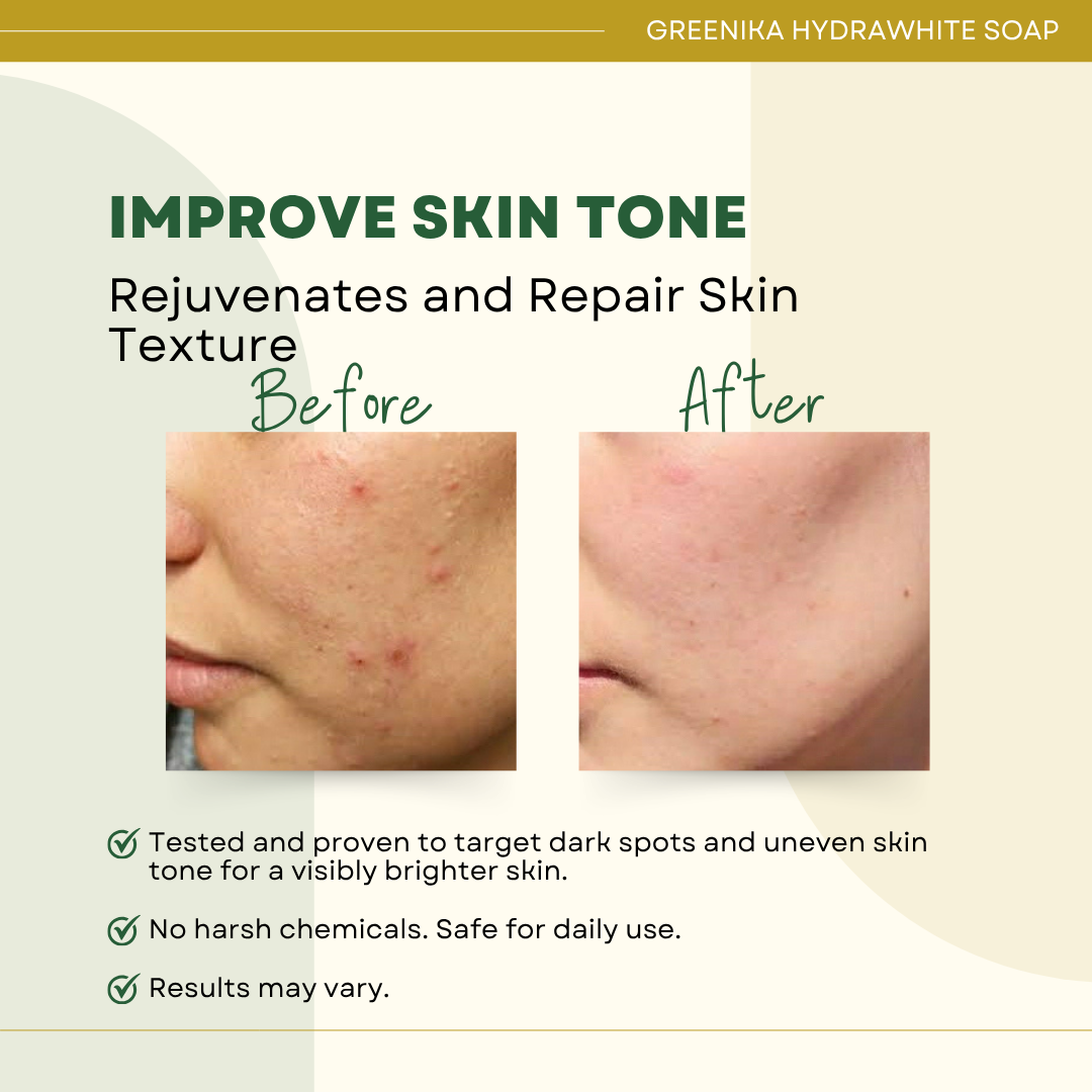Greenika Hydrawhite Intense Moisturizer Soap