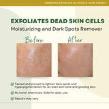 Greenika Exfolika 5% Glycolic Acid Cream
