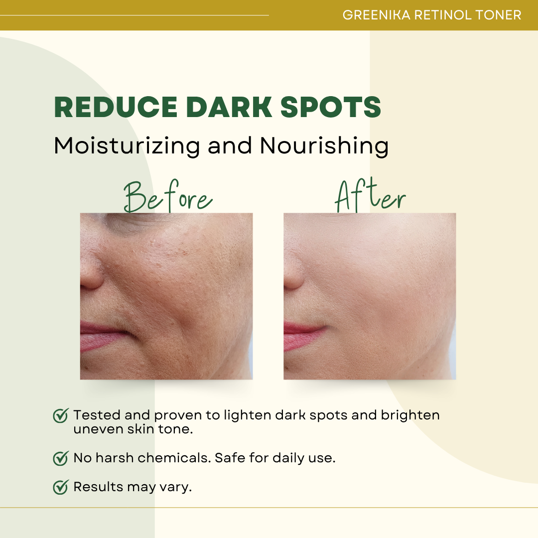 Greenika Retinol Toner