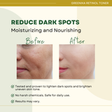 Greenika Retinol Toner