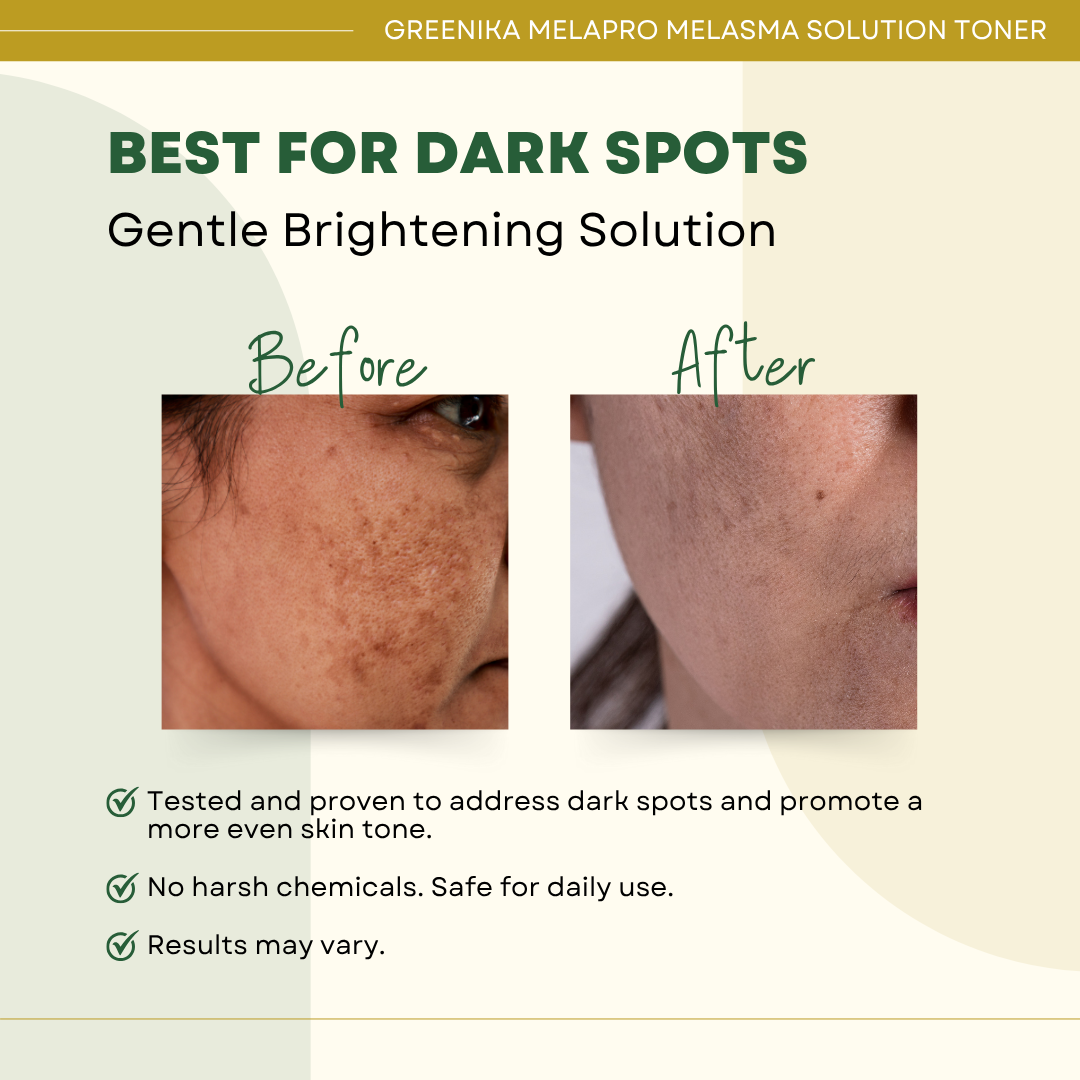 Greenika MelaPro Solution