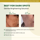 Greenika MelaPro Solution