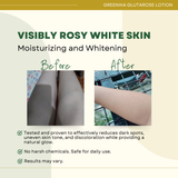 Greenika Glutathione & Rosehip Moisturizing Whitening Lotion
