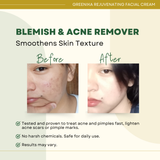 Greenika Anti Aging Rejuvenating Cream
