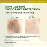 Greenika 10X Underarm Whitening Serum