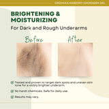 Greenika Niaberry Underarm Whitening Gel