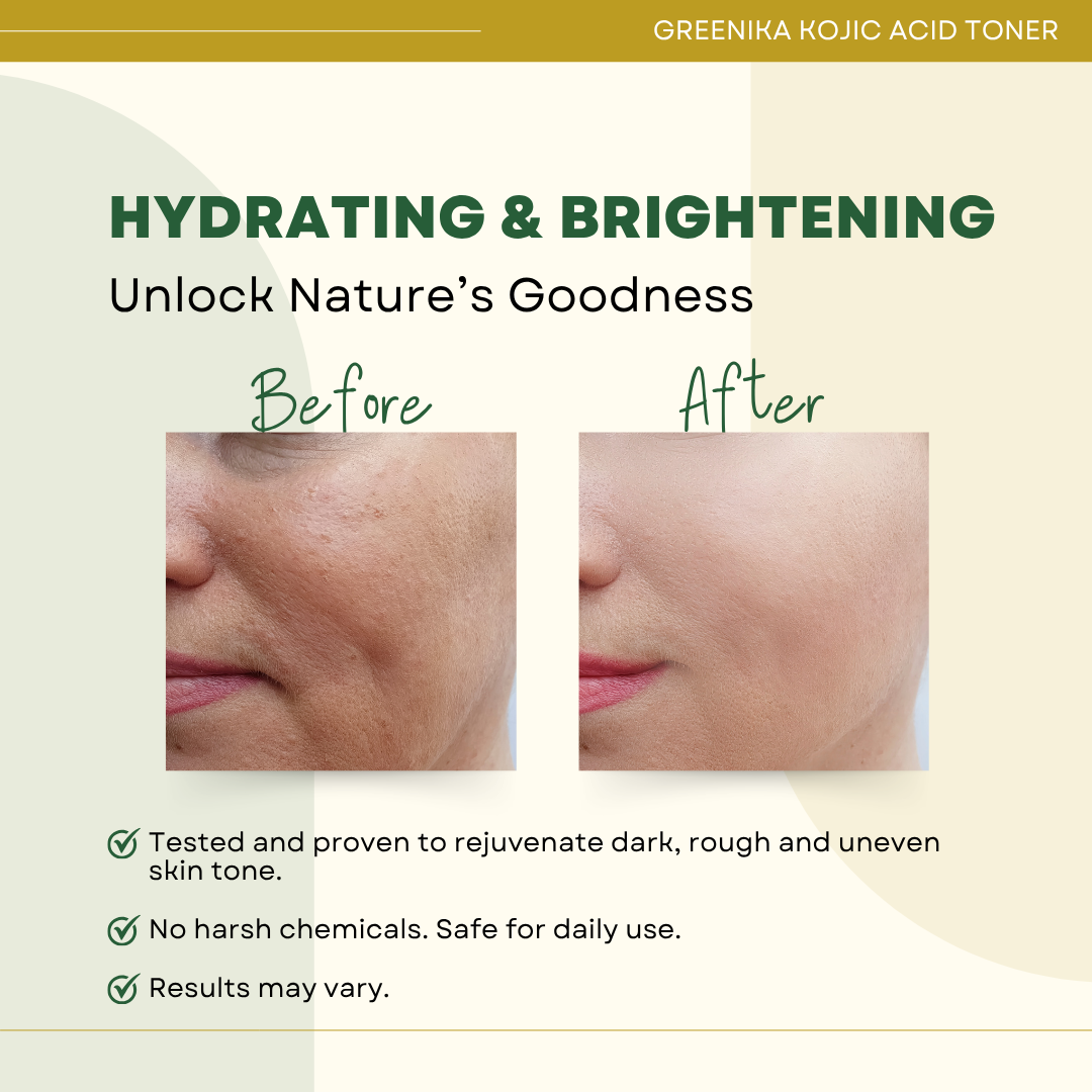 Greenika Kojic Acid Toner
