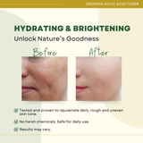 Greenika Kojic Acid Toner