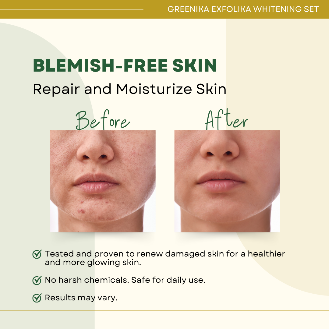 Greenika Exfolika Whitening Set