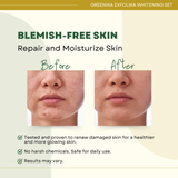 Greenika Exfolika Whitening Set