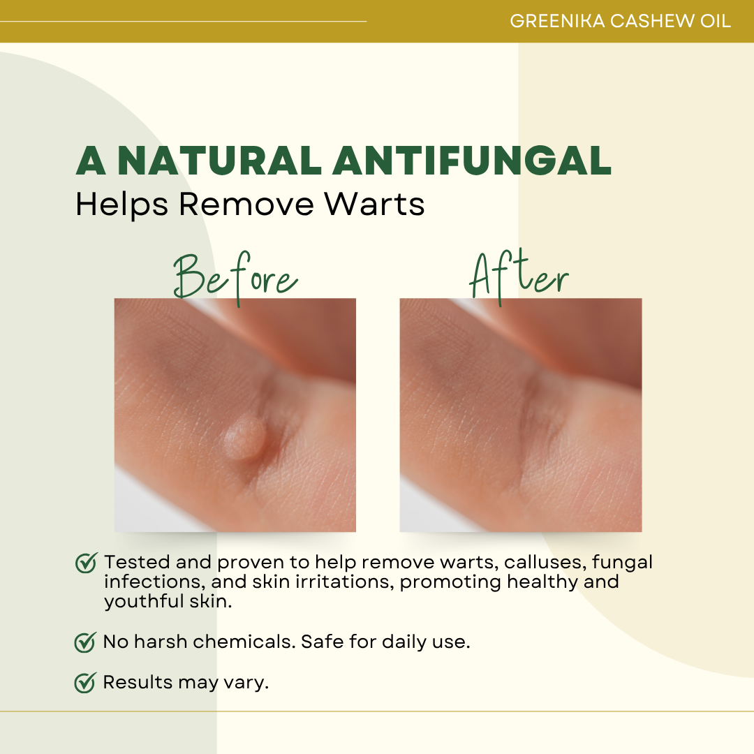 Greenika Cashew Carrier Essential Oil