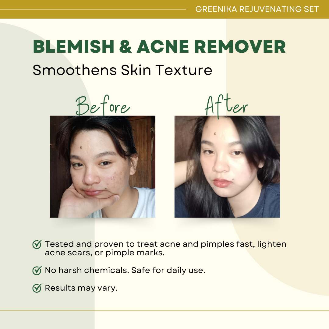 Greenika Rejuvenating Acne Remover Set