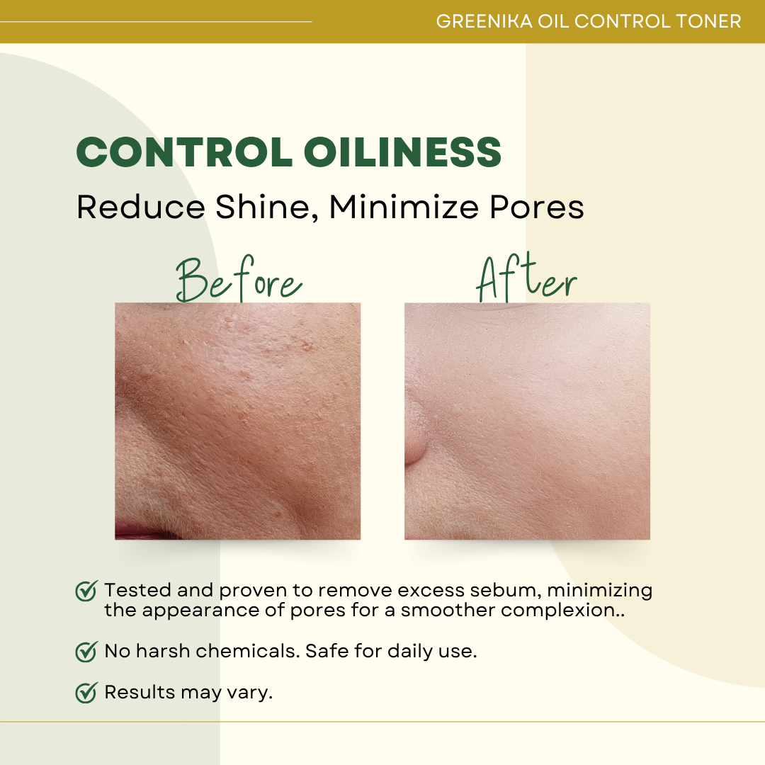 Greenika Oil Control Facial Toner