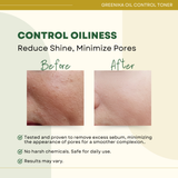 Greenika Oil Control Facial Toner