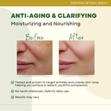 Greenika Retinol Best Anti-Aging Serum