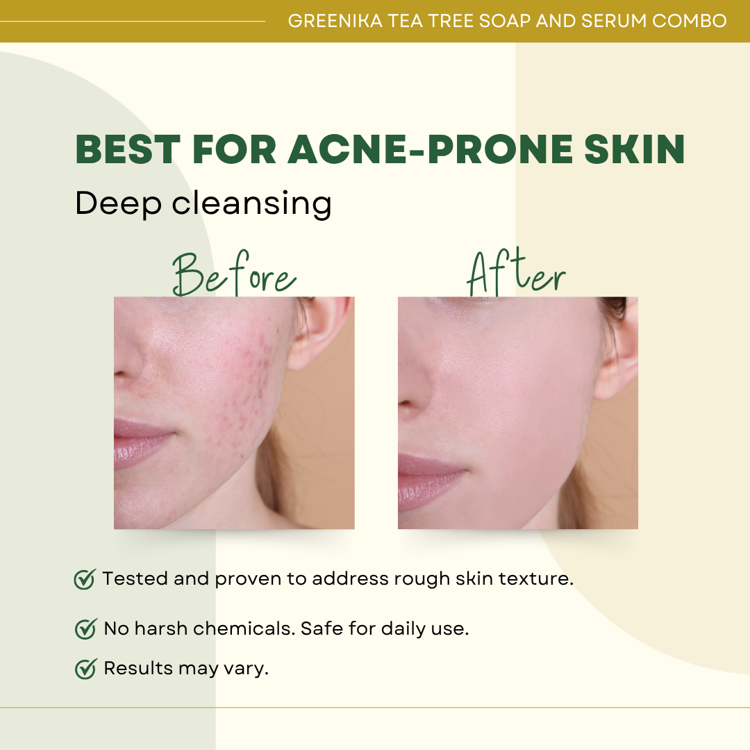 Greenika Tea Tree Combo Face Serum & Soap