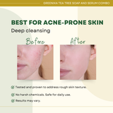 Greenika Tea Tree Combo Face Serum & Soap