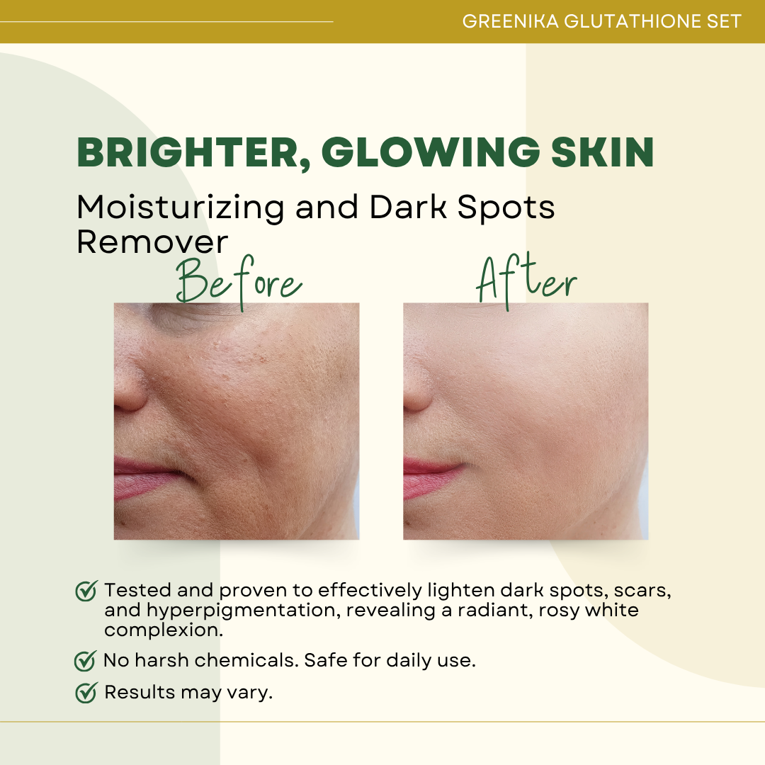 Greenika Glutathione 4pc Set