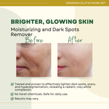 Greenika Glutathione 4pc Set