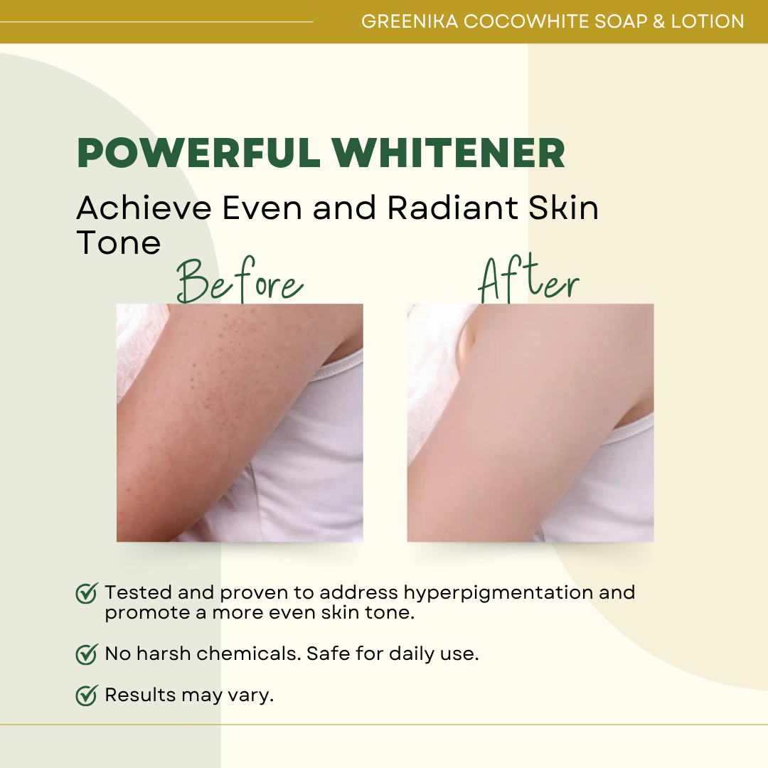 Face & Body Whitening Lotion & Coco-White Soap Combo