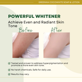 Face & Body Whitening Lotion & Coco-White Soap Combo