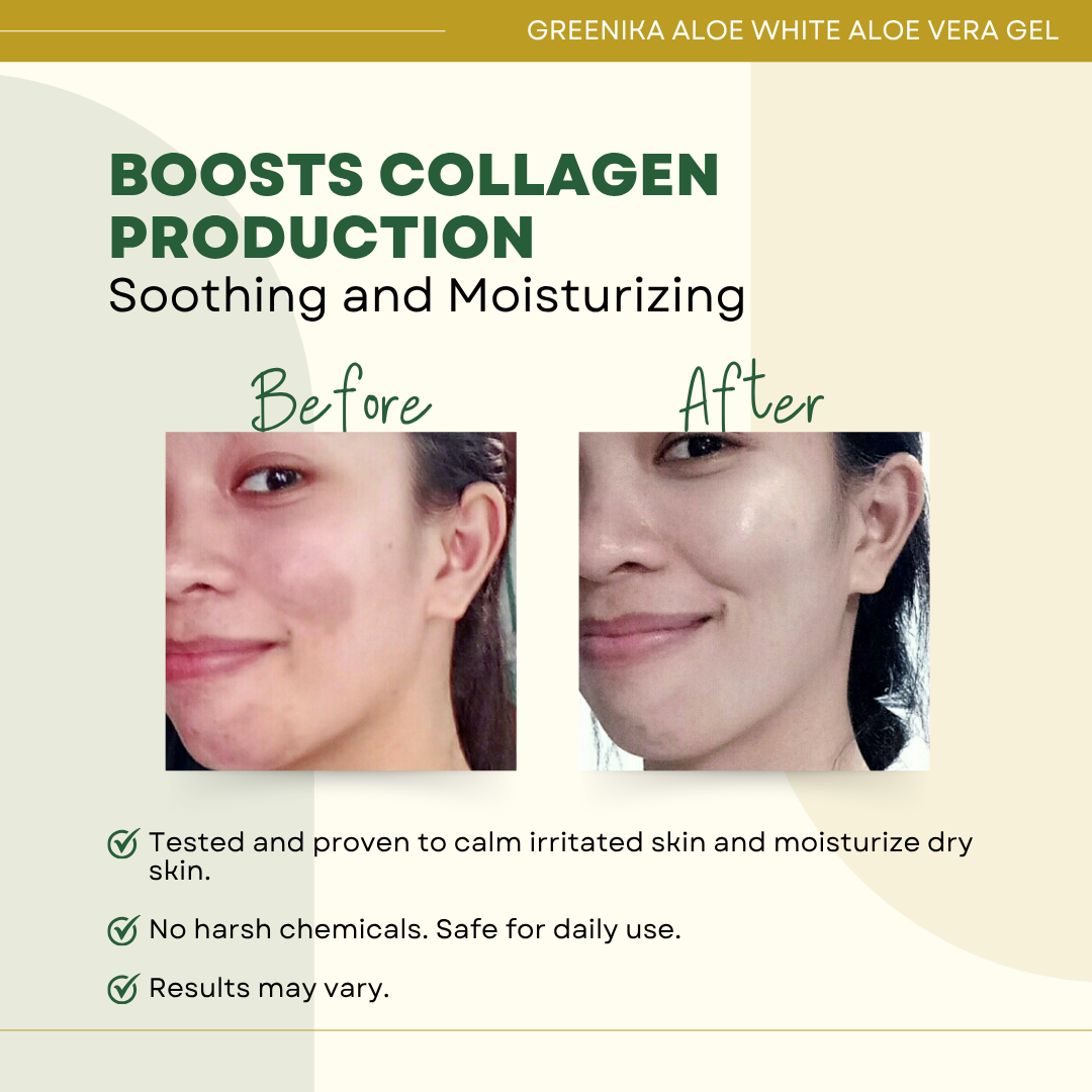 Greenika Aloe Vera Gel Whitening & Moisturizer for Face and Body