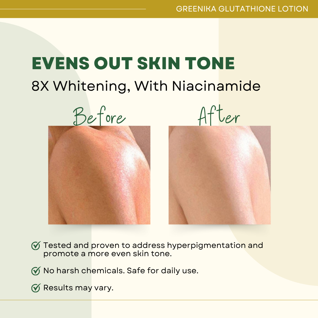 Greenika Glutathione Moisturizing Whitening Lotion