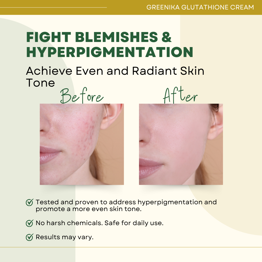 Greenika Glutathione Anti Aging Whitening Cream