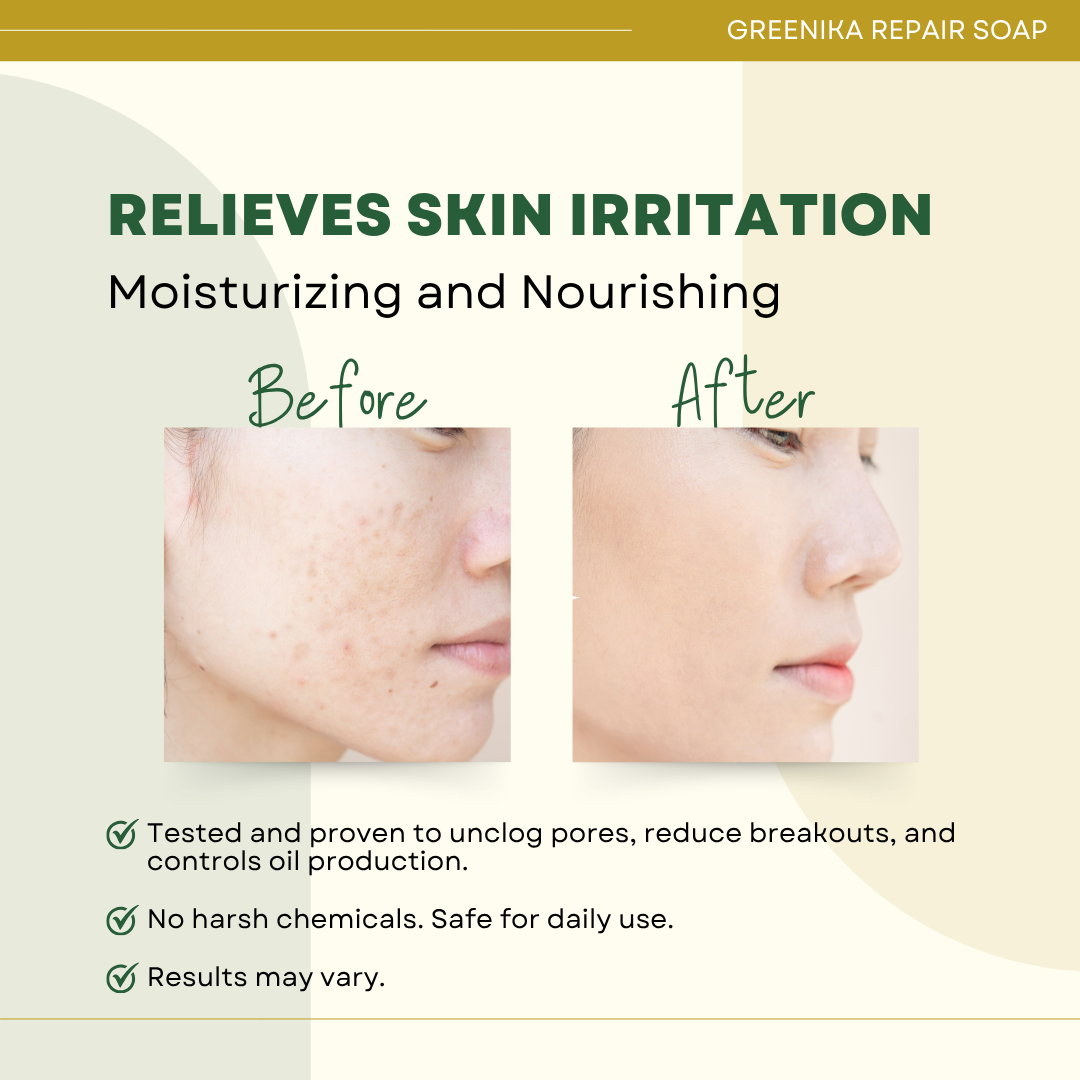 Greenika Repair Soap