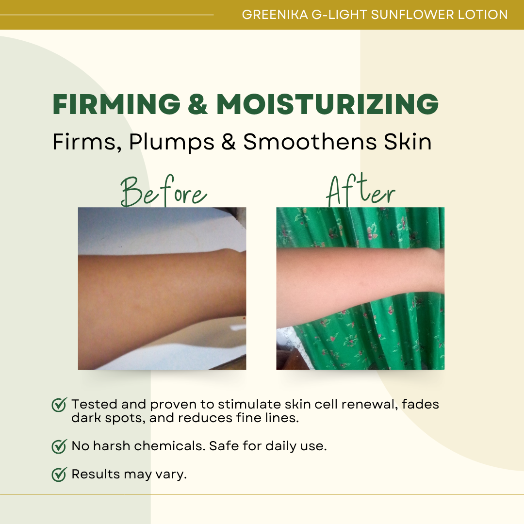[ WHITENING + DARK SPOT CORRECTOR ] Greenika G-Light Sunflower Lotion