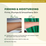 [ WHITENING + DARK SPOT CORRECTOR ] Greenika G-Light Sunflower Lotion