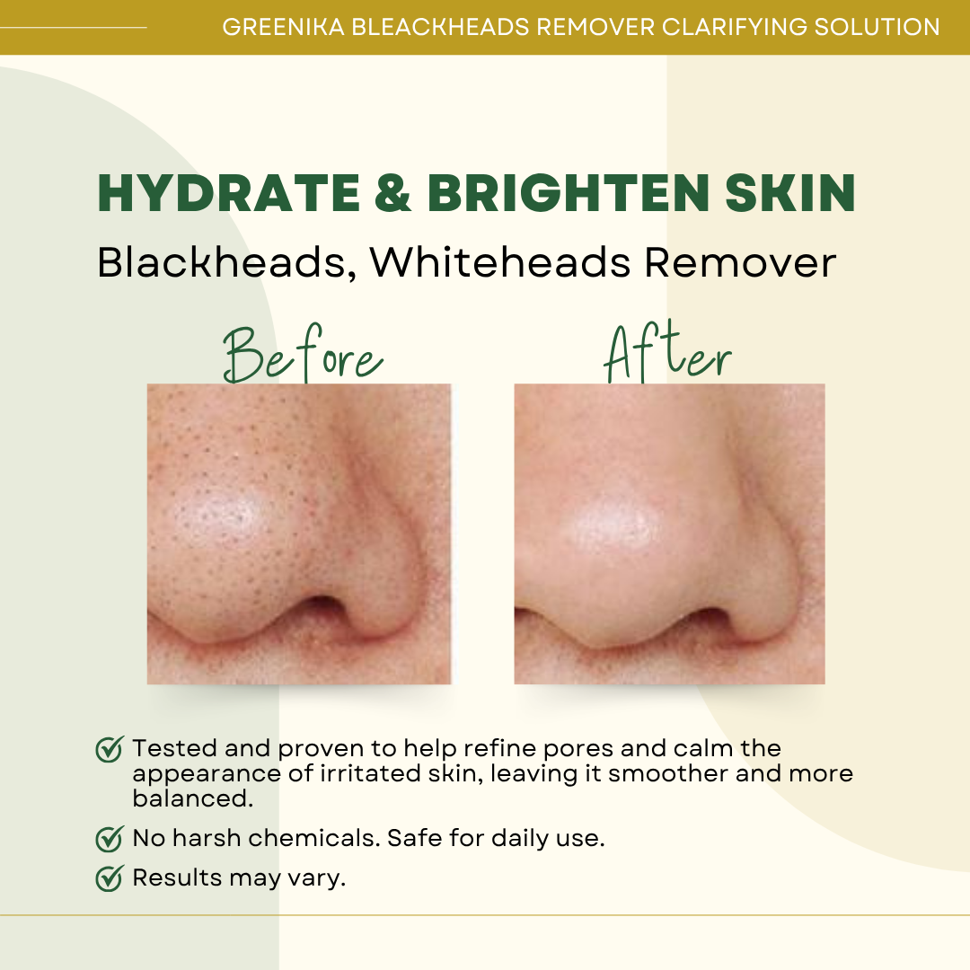 Greenika Blackhead Remover Whitehead Remover Facial Toner